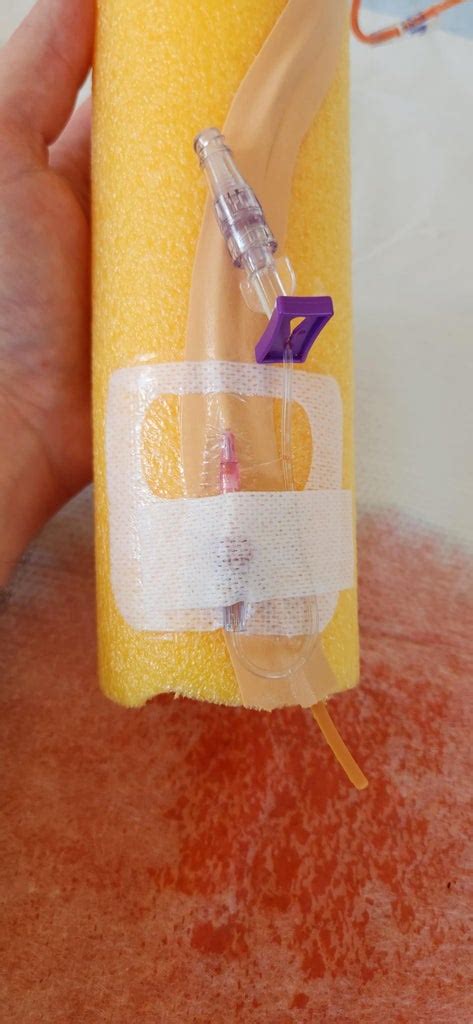 fake blood in an iv bag reddit|Fake Arm for IV Insertion and Venipuncture Practice.